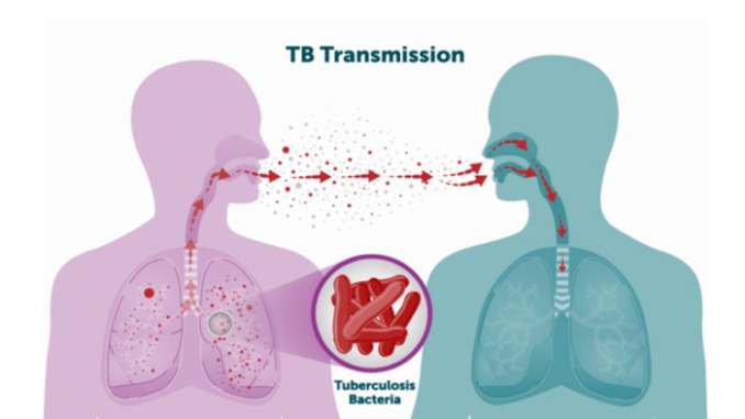 New TB Vaccines Poised to Save Millions, But Gavi Urges Proactive Market Shaping